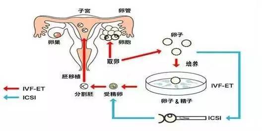 厦门试管婴儿